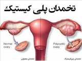 برگزاری برنامه آموزشی با عنوان "اداره و درمان تخمدان پلی کیستیک" در مورخه 15 تیر 98